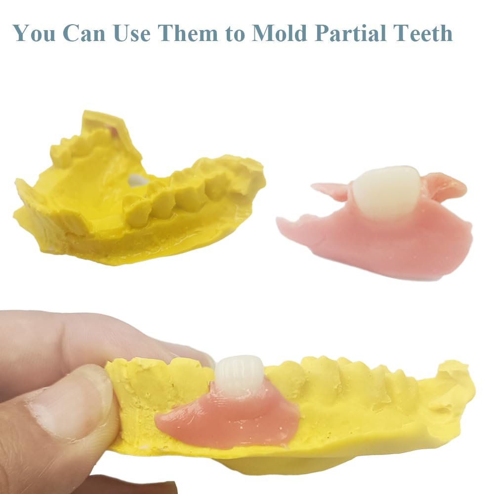 DIY Denture Complete Kit with Impression Material, Gum Material, Components for Top and Bottom Full or Partial Dentures D27692